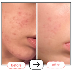 AccuFix Vitamin C Brightening Serum